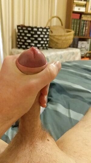 My messy foreskin