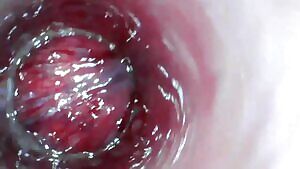 squeezing my bladder sphincter