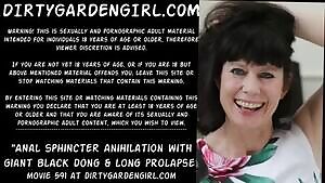 Anal sphincter anihilation with giant black dong & long prolapse