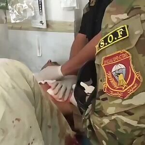 An unbelievable case of a gunshot wound with the heart protruding through the chest wall!