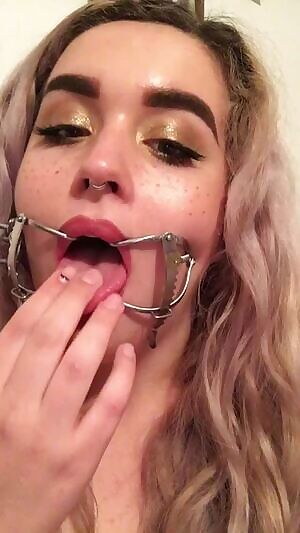 dental gags make me smile