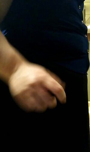 Yes, those are faded hickies on my ass. You should see the ones on my back.