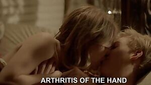 ARTHRITIS OF THE HAND