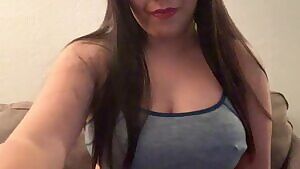 How does Reddit like my braces?