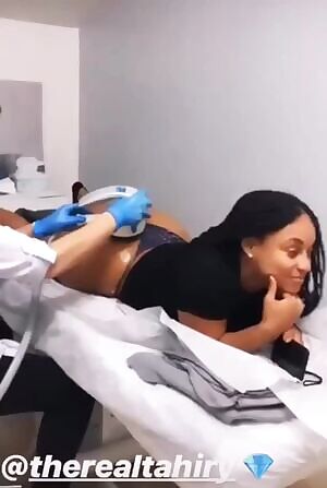 Ms.Jose with the cellulite treatment to keep them buns right 🍑👀