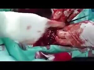 This amputation looks wrong...does it take that long to cut through bone?